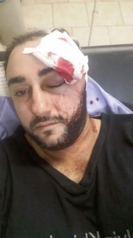 Ezequiel Fulmann de 31 anos de idade, foi atingido de raspão na altura do supercílio e na perna esquerda, onde já recebeu alta (Foto: Divulgação)